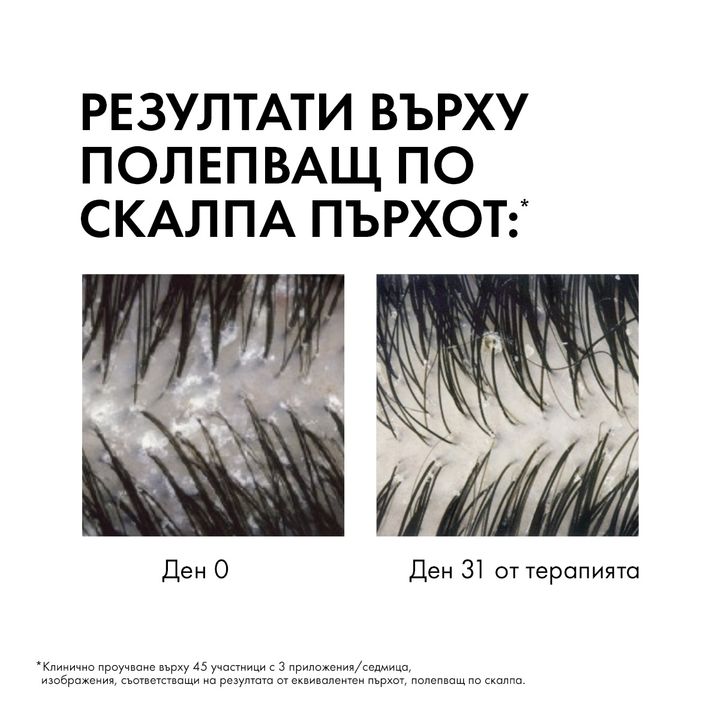 Vichy Dercos Третиращ шампоан против пърхот за нормална до мазна коса x390 мл