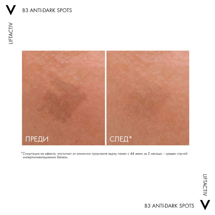 Vichy Liftactiv Specialist B3 Серум за лице против пигментни петна x30 мл