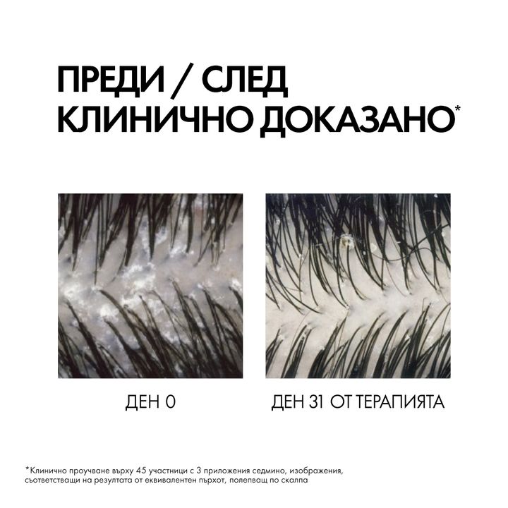 Vichy Dercos 2in1 Шампоан и балсам за коса против пърхот x200 мл